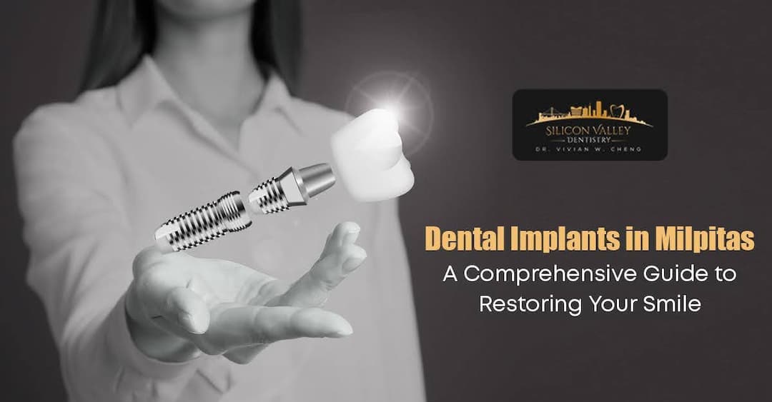 Dental Implants in Milpitas