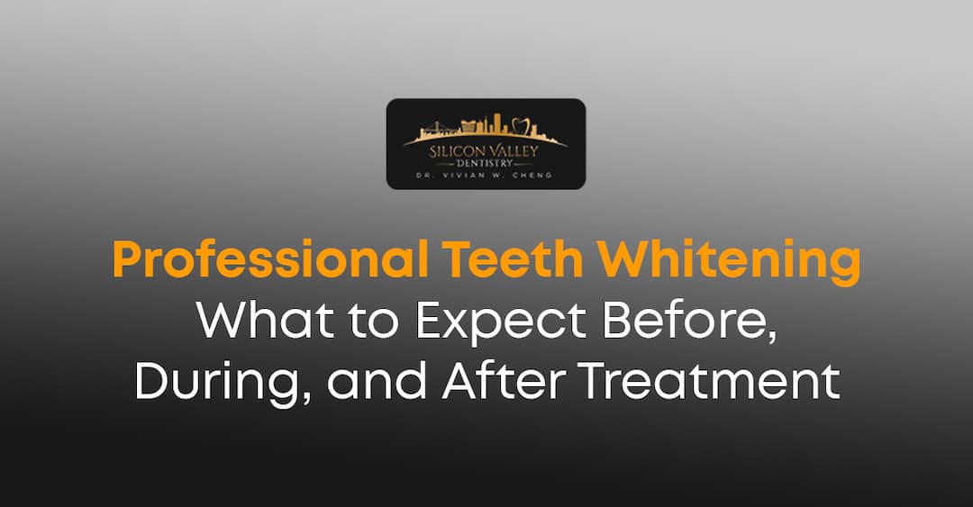 Professional Teeth Whitening: Before, During & After Care