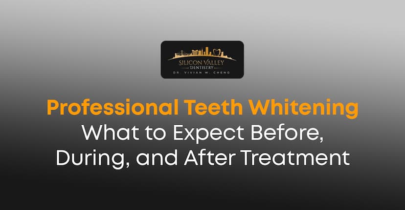 Professional Teeth Whitening: Before, During & After Care